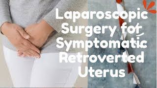Laparoscopic Surgery for Symptomatic Retroverted Uterus