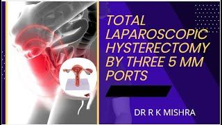 TAPP Inguinal Hernia Repair by Ipsilateral Port