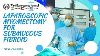 Laparoscopic Myomectomy for Submucous Myoma