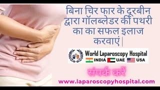 Laparoscopic Cholecystectomy lecture by Dr R K Mishra