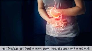 Laparoscopic Surgery For Ovarian Dermoid Cyst