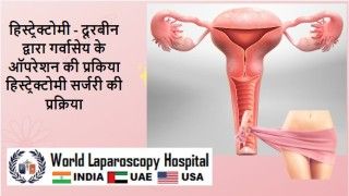 Laparoscopic Nephrectomy