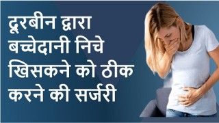 लेप्रोस्कोपिक मायोमेक्टोमी क्या है? फाइब्रॉएड गर्भाशय के लिए उपचार और कौनसा मेरे लिए सबसे अच्छा है?