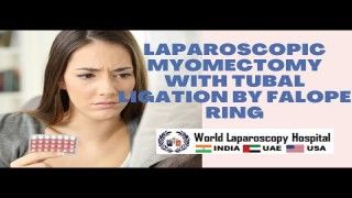 Laparoscopic Myomectomy with Tubal Ligation by Falope Ring