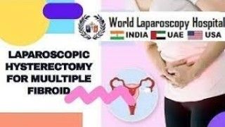 Laparoscopic Management of Ruptured Appendix