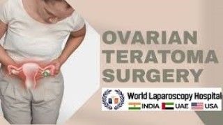 Laparoscopic Removal of Ovarian Teratoma