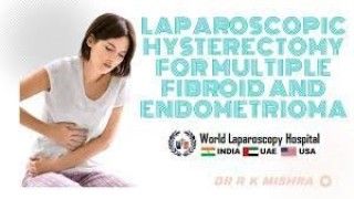 Laparoscopic Hysterectomy for Multiple Fibroid and Endometrioma