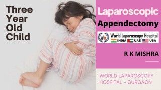 Laparoscopic Appendectomy for Acute Appendicitis (Retrocecal Appendix)
