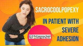 Sacrocolpopexy in patient with severe adhesion