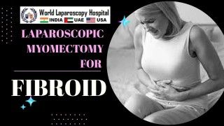 Laparoscopic Myomectomy for Intramural Fibroid using Baseball Suturing