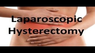 Left Sided Ovarian Cyst Laparoscopic Approach