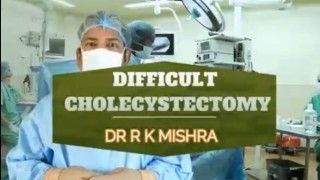 Robotic Cholecystectomy for Empyema Gallbladder