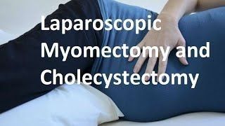 Laparoscopic Myomectomy and Salpingo-oophorectomy with Palmer's Point and Extraction by Colpotomy