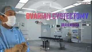 Left Sided Ovarian Cyst Laparoscopic Approach