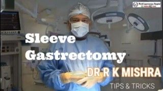 Sleeve Gastrectomy Tips and Tricks