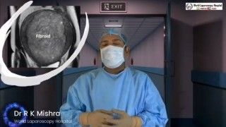 Laparoscopic Resection of a Torted Ovarian Dermoid Cyst