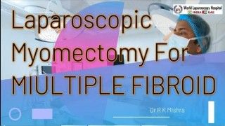 Laparoscopic myomectomy instead of hysteroscopic myomectomy for large submucous fibroid.