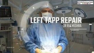 TAPP Hernia Repair by Ipsilateral Port