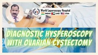 Laparoscopic tubal sterilization