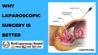 Robotic Bilateral Ovarian Cystectomy