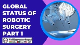 Laparoscopic Myomectomy for Large Uterine Fibroid