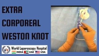 Transanal Endoscopic Miscrosurgery