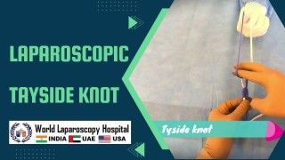 Fellowship in Laparoscopic Surgery in Dubai