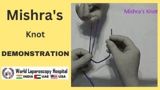 Laparoscopic Repair of Recurrent Incisional Hernia by Two Port by Dr R K Mishra