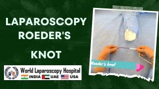 Laparoscopic Hysterectomy And Appendectomy Using Illuminated Ureteral Stent Step Step Demonstration