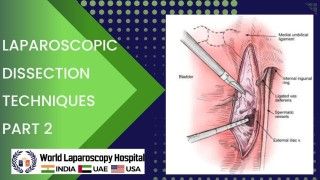 Dr. R.K. Mishra demonstrating Female Laparoscopic Sterilization by Falope Ring