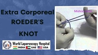 IPOM Laparoscopic Inguinal Hernia Repair