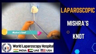 Mastering Laparoscopic Technique: Recurrent Incisional Hernia Repair by Laparoscopy Simplified