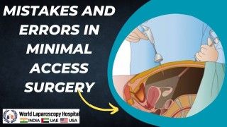 IPOM Laparoscopic Inguinal Hernia Repair