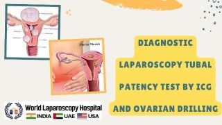 Revolutionizing Infertility Treatment: Laparoscopic Tests and Procedures for Improved Outcomes
