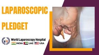 How to Perform Safe Diagnostic Laparoscopy - Lecture by Dr R K Mishra