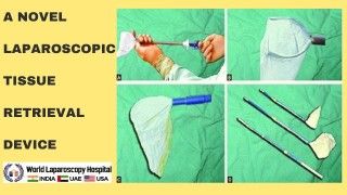 International Patients at World Laparoscopy Hospital