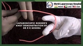 Total Laparoscopic Hysterectomy with Sacrocolpopexy