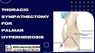 Robotic Sleeve Gastrectomy and Cholecystectomy