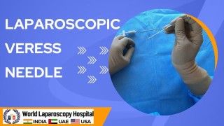 Laparoscopic Sacrocolpopexy for Vaginal Vault Prolapse