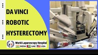 Fundus First Cholecystectomy