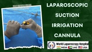 Laparoscopic Roeder's Knot