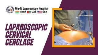 Laparoscopic Myomectomy for Intramural Fibroid