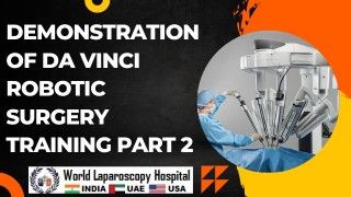 Laparoscopic Hysterectomy And Appendectomy Using Illuminated Ureteral Stent Step Step Demonstration