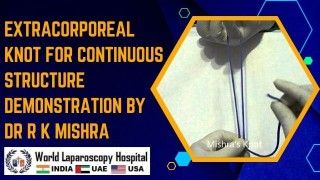 TAPP Inguinal Hernia Repair by Ipsilateral Port