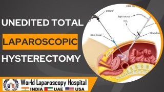 Revolutionizing Hysterectomy: The Power of Unedited Total Laparoscopic Surgery