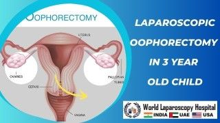 What is Hernia? Its causes and treatment using Laparoscopy