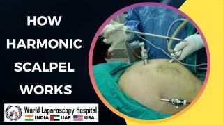 Minimally Invasive Hysterectomy with Sacrocolpopexy: Treating Pelvic Organ Prolapse Laparoscopically