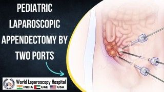 Total Laparoscopic Hysterectomy by Myoma Screw Without Uterine Manipulator