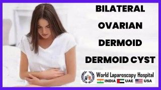 Bilateral Ovarian Dermoid Cyst: Managing Symptomatic Dermoid Cysts on Both Ovaries