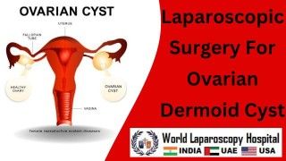 Laparoscopic Ovarian Cystectomy: Minimally Invasive Removal of Dermoid Cysts